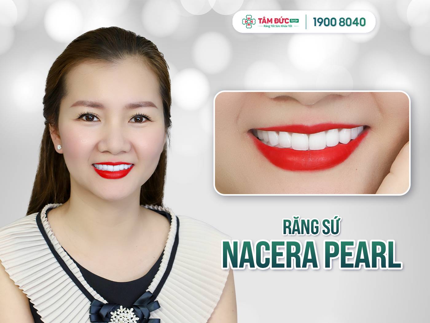 CÁC LOẠI RĂNG SỨ PHỔ BIẾN NHẤT HIỆN NAY