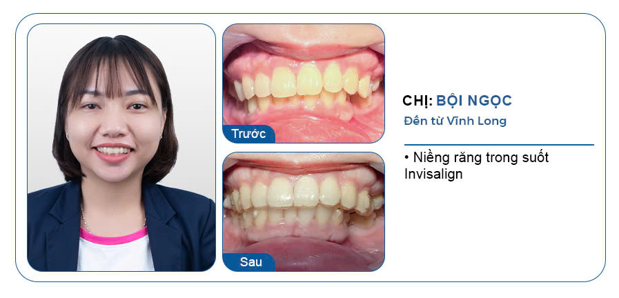 CHỊ BỘI NGỌC