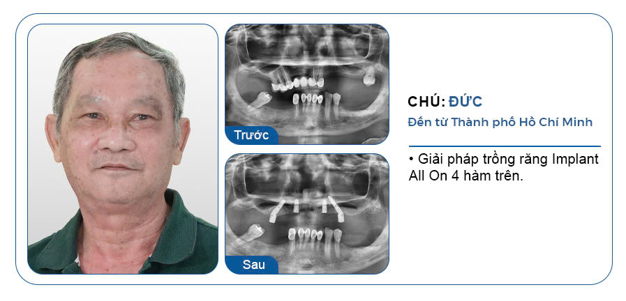 CHÚ ĐỨC