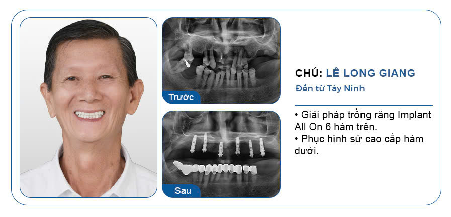 CHÚ LONG GIANG