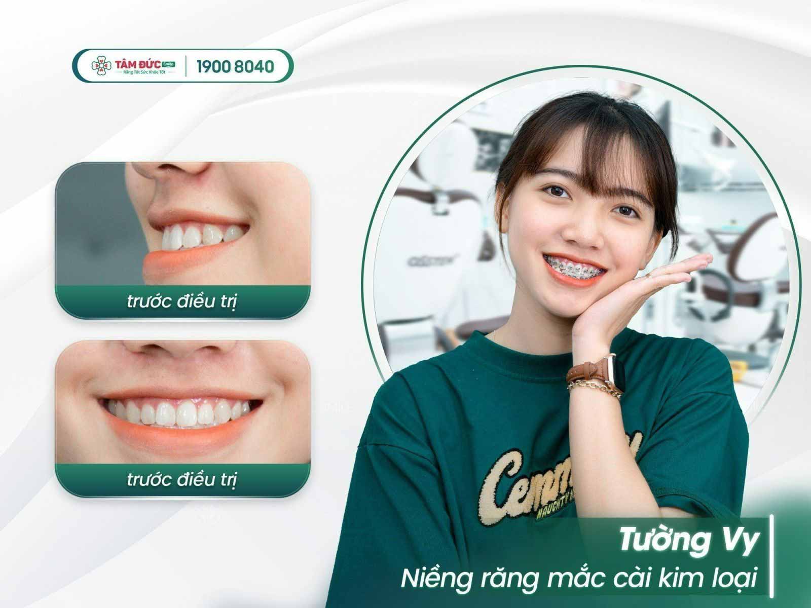 nieng-rang-gia-bao-nhieu-tien