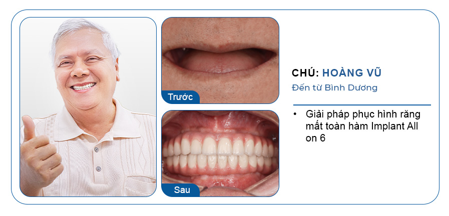 CHÚ VŨ