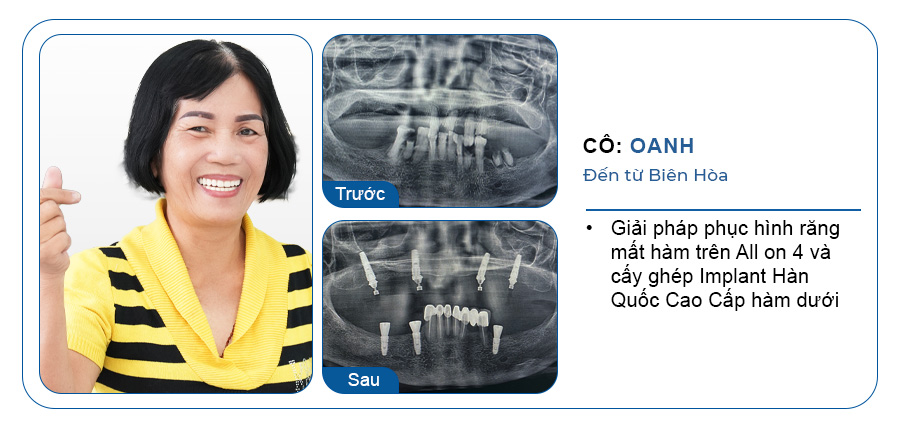 CÔ OANH