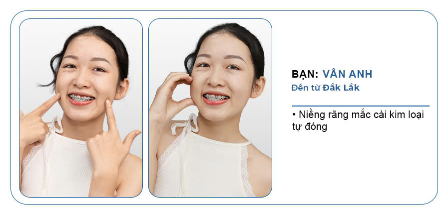 CHỊ VÂN ANH