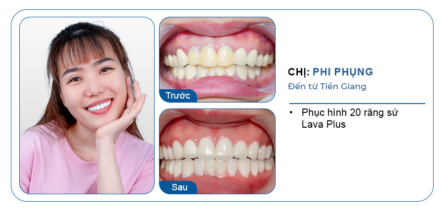 CHỊ PHI PHỤNG