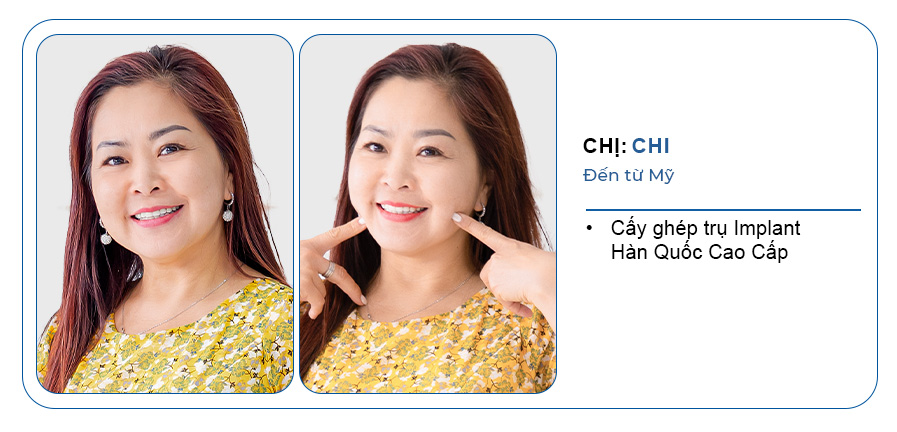 CHỊ CHI