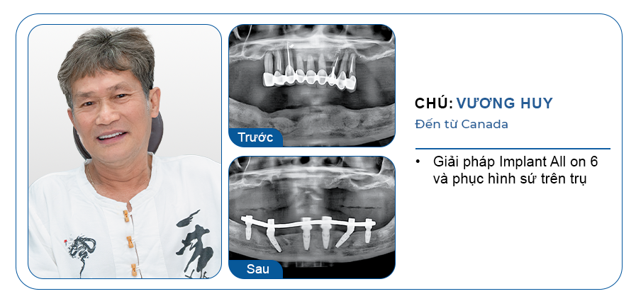 CHÚ VƯƠNG HUY