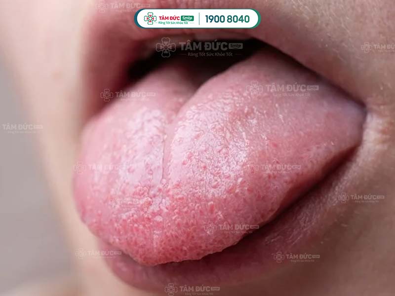 lưỡi