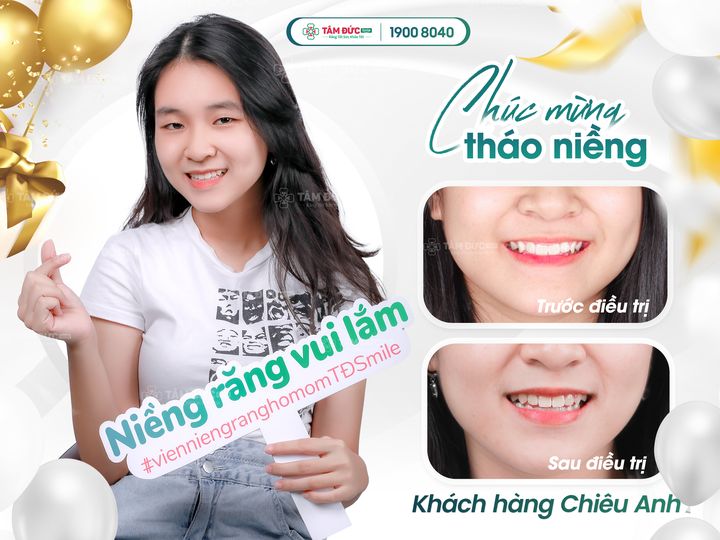 nieng-rang-mac-cai-kim-loai-40