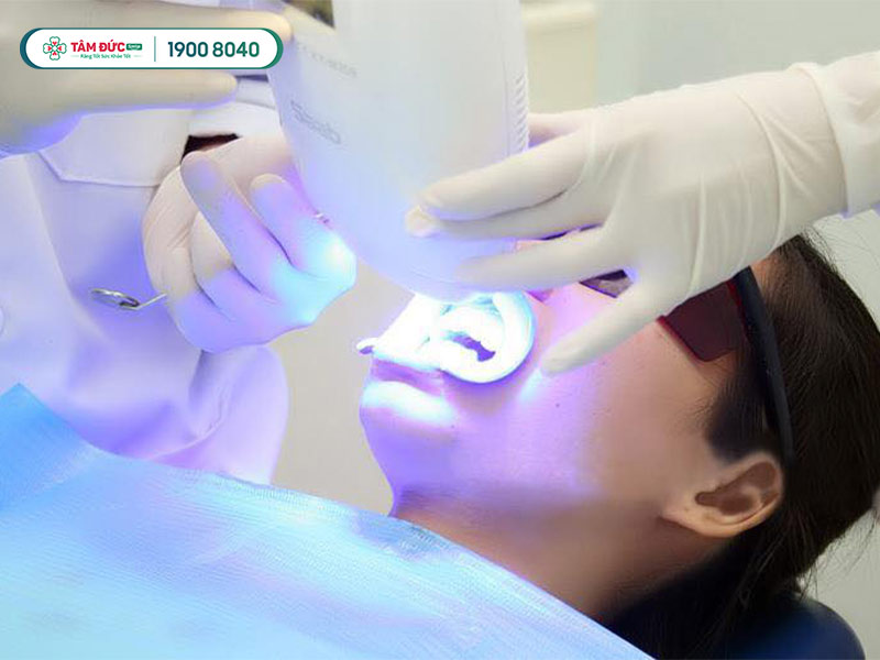 phương pháp tẩy trắng răng tại nhà