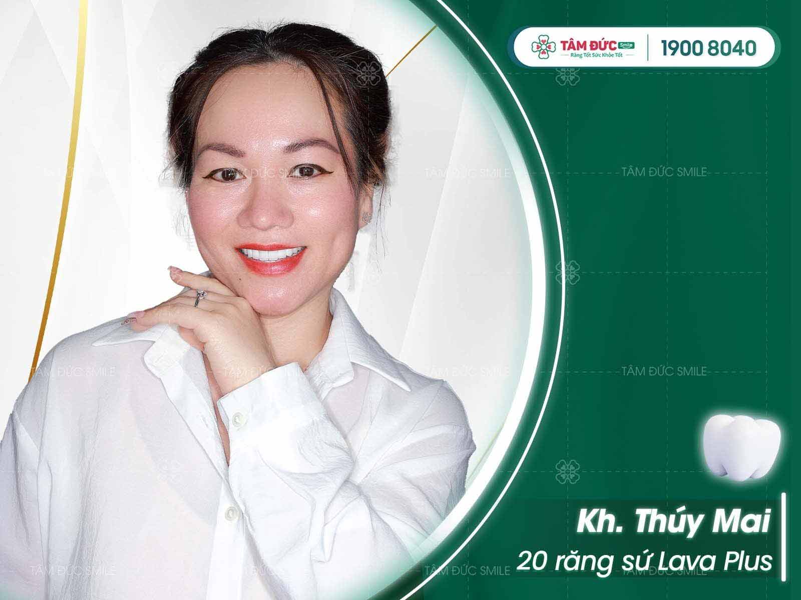 răng cối là gì