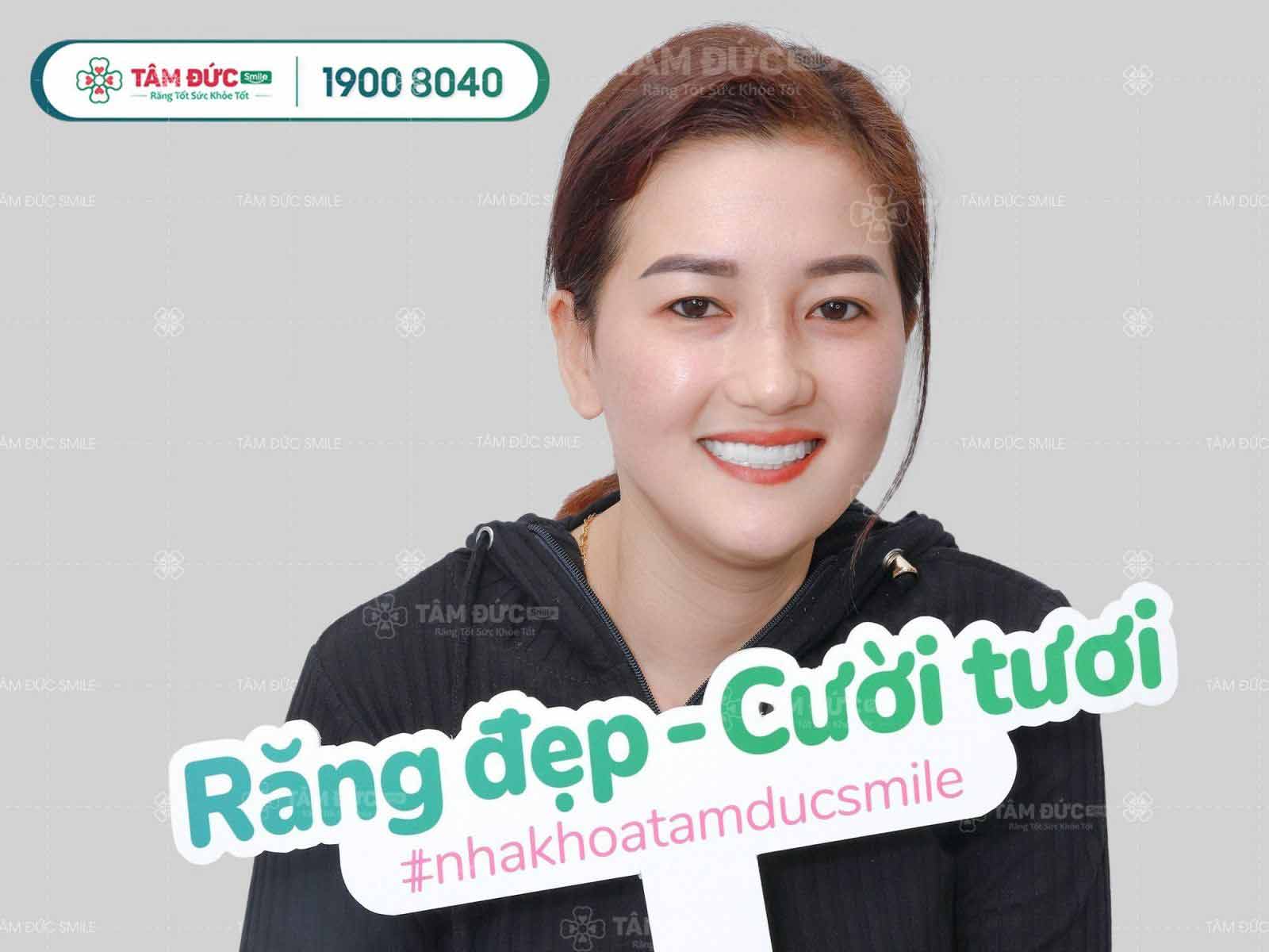 giá tẩy trắng răng tại nhà