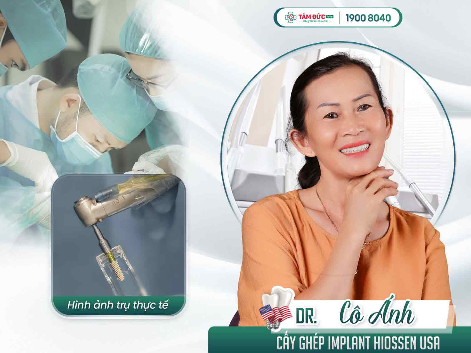 trồng răng sứ có đau không