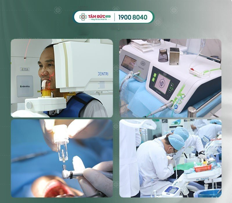 trồng răng sứ có đau không