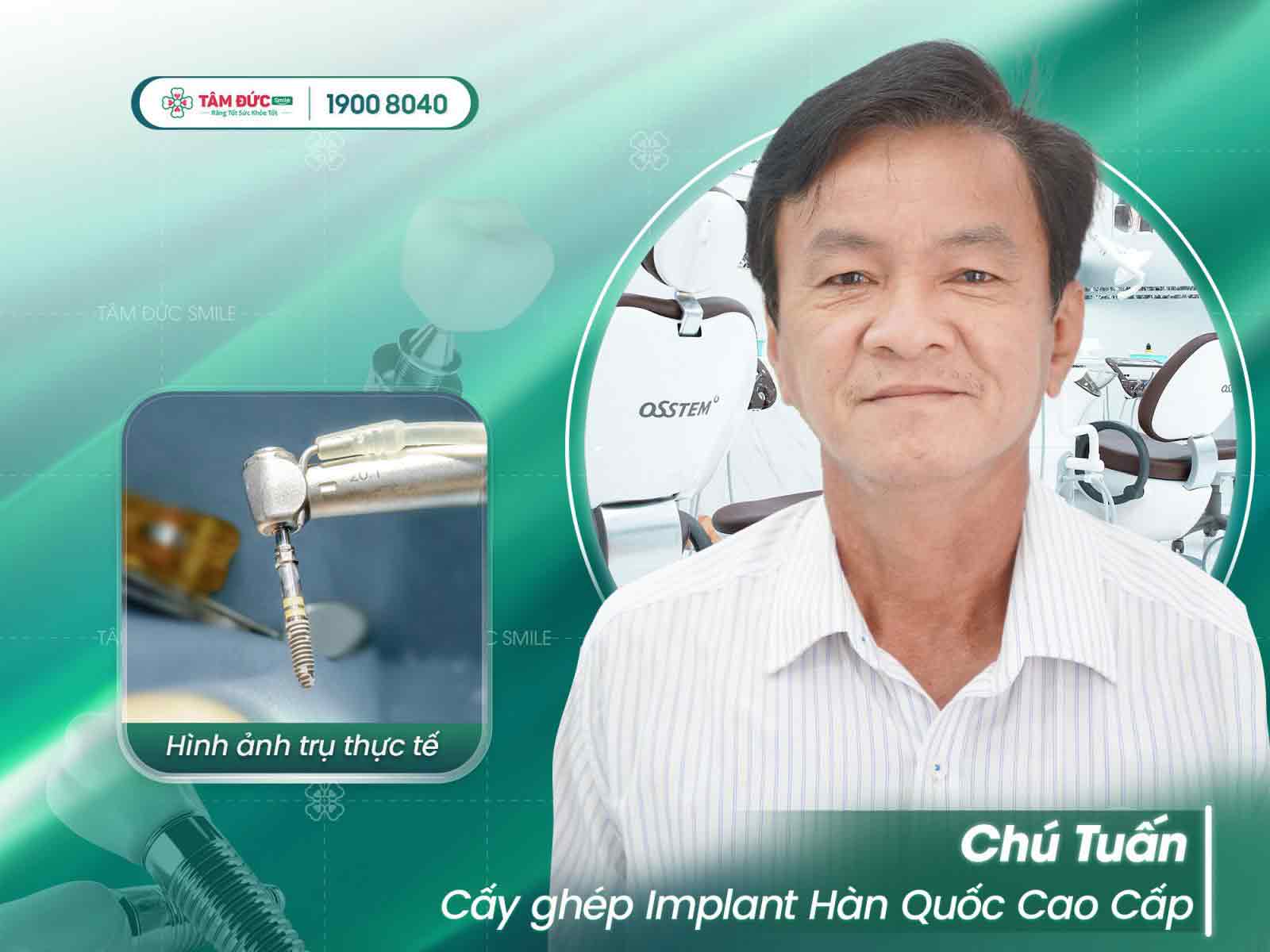 chú tuấn sau khi trồng răng Implant tại tâm đức smile