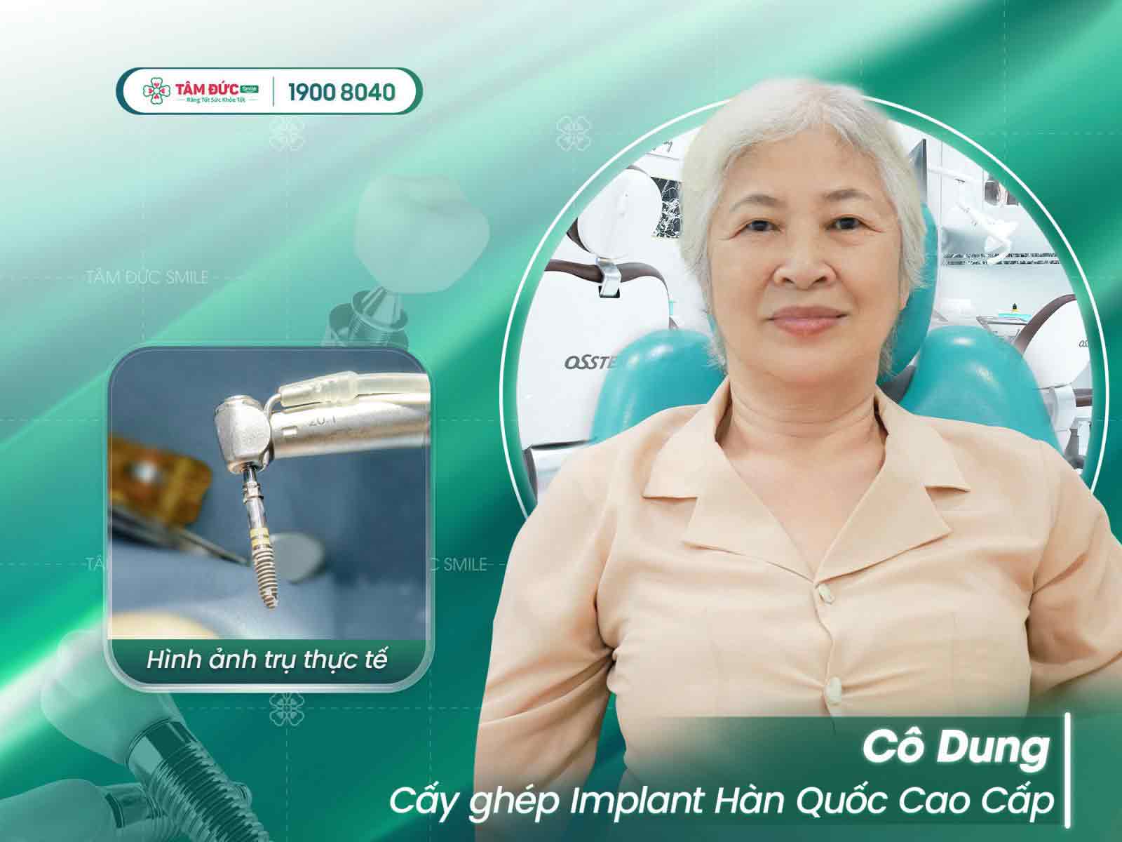 cô Dung sau khi trồng răng tại tâm đức smile