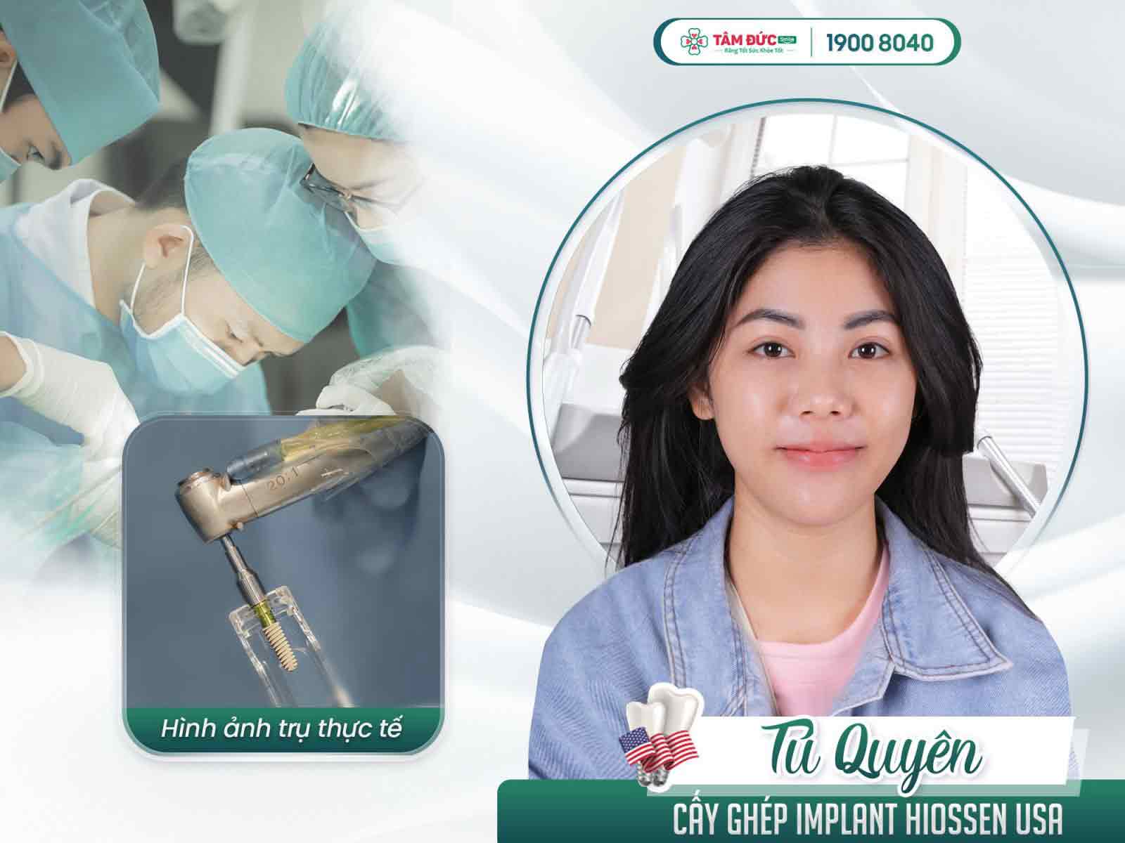 trồng răng sứ có đau không